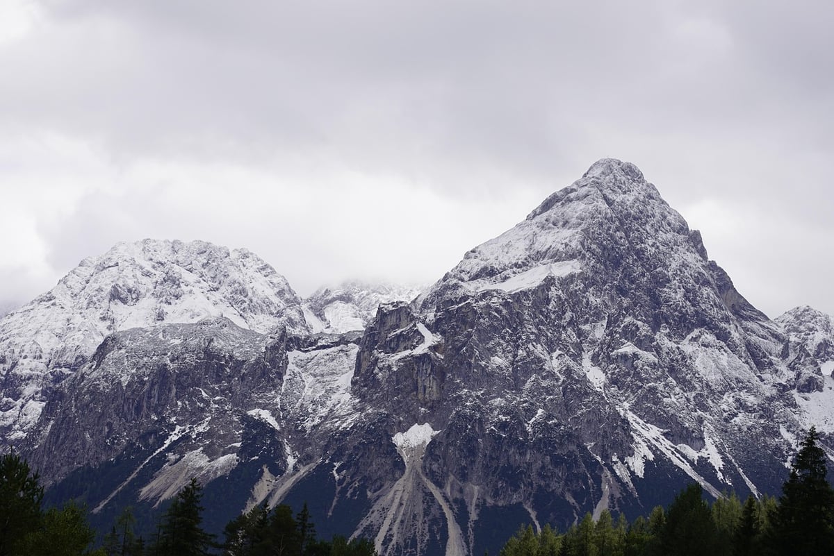 Découvrir les « crétins des Alpes » : ces individus au physique particulier et lourdement affectés