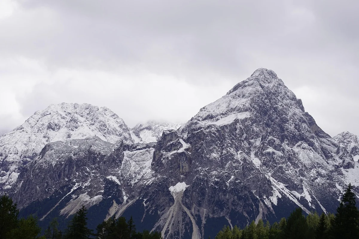 Découvrir les « crétins des Alpes » : ces individus au physique particulier et lourdement affectés