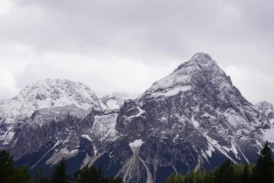 Découvrir les « crétins des Alpes » : ces individus au physique particulier et lourdement affectés